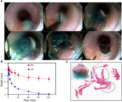Injectable temperature-sensitive hydrogel facilitating endoscopic submucosal dissection